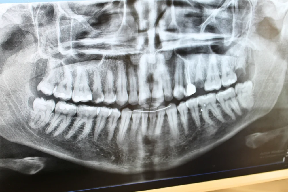 radiografia