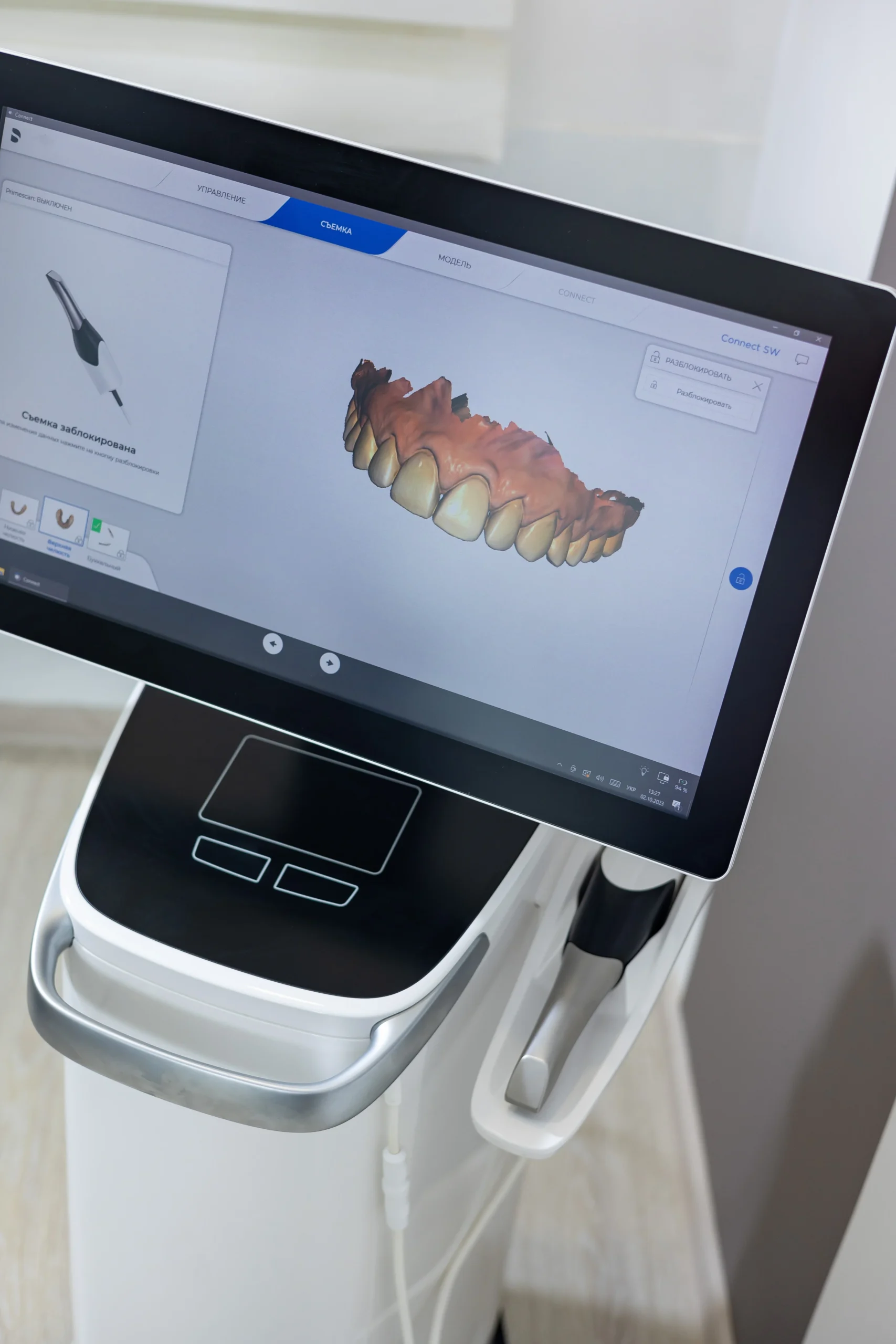 Modelo 3D de una arcada dental en la pantalla del escáner