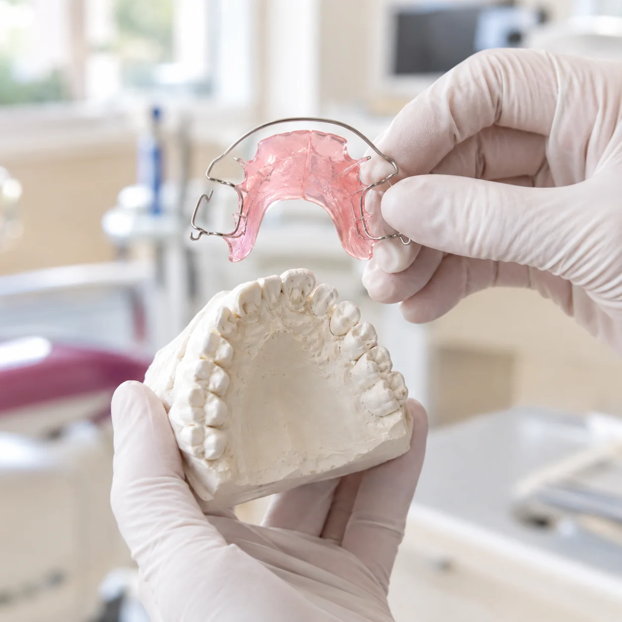 Aparato de ortodoncia infantil removible sobre un modelo